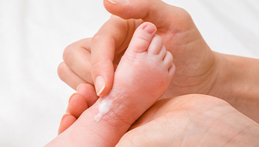 Baby_eczema_Desktop Article Pages 375x213px